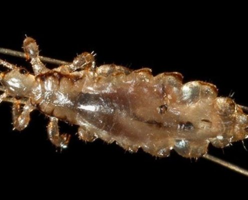 Head Lice Myths You Shouldn't Believe